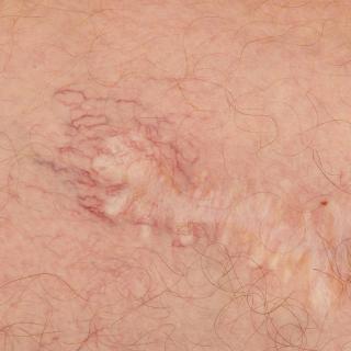 Photo Textures of Human Skin